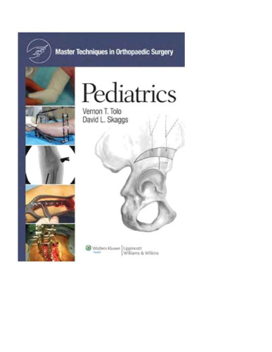 Master Techniques in Orthopaedic Surgery Pediatrics
