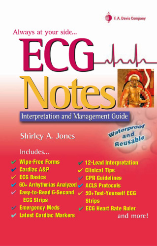 ECG Notes: Interpretation And Management Guide