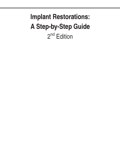 Implant Restorations: A Step-by-Step Guide, 2nd Edition