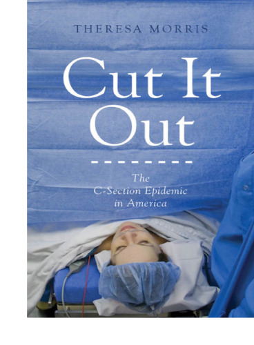 Cut It Out: The C-Section Epidemic in America