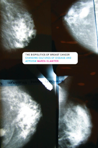 The Biopolitics of Breast Cancer: Changing Cultures of Disease and Activism
