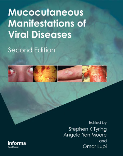 Mucocutaneous Manifestations of Viral Diseases