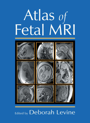 Atlas of fetal MRI