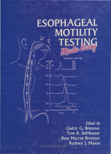 Esophageal Motility Testing