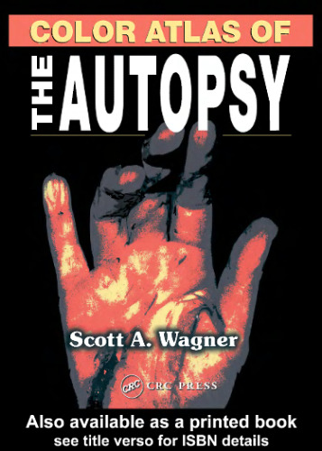 Color Atlas of the Autopsy