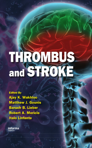 Thrombus and Stroke (Neurological Disease and Therapy)