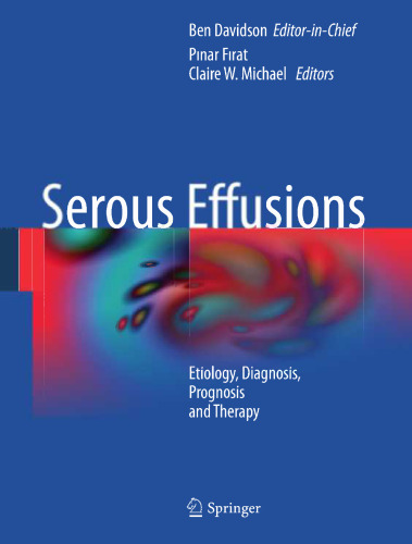Serous Effusions: Etiology, Diagnosis, Prognosis and Therapy