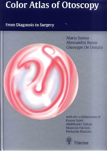 Color Atlas of Otoscopy