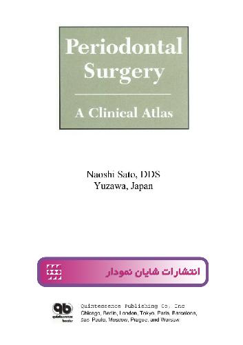 periodontal surgery