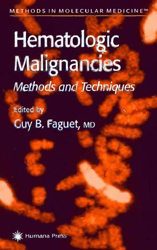 Hematologic Malignancies: Methods and Techniques
