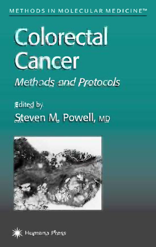 Colorectal Cancer: Methods and Protocols