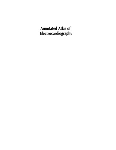Annotated Atlas of Electrocardiography: A Guide to Confident Interpretation