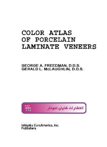 Color atlas of Laminate porcelain Veneers