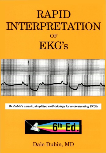 Rapid Interpretation of EKG's
