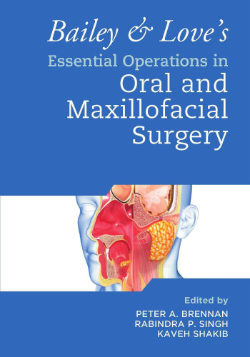 Bailey & Love's Essential Operations in Oral and Maxillofacial Surgery
