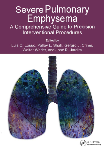 Severe Pulmonary Emphysema: A Comprehensive Guide to Precision Interventional Procedures