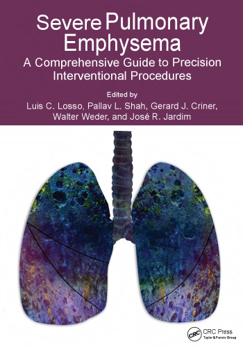 Severe Pulmonary Emphysema: A Comprehensive Guide to Precision Interventional Procedures