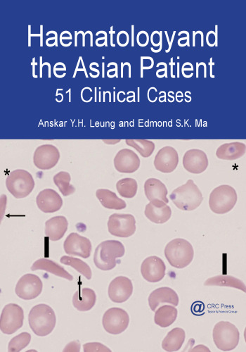 Haematology and the Asian Patient: 51 Clinical Cases