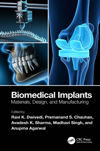 Biomedical Implants. Materials, Design, and Manufacturing