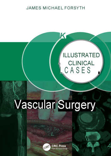 Vascular Surgery
