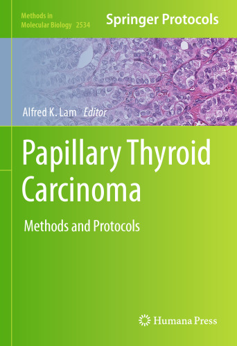 Papillary Thyroid Carcinoma: Methods and Protocols (Methods in Molecular Biology, 2534)