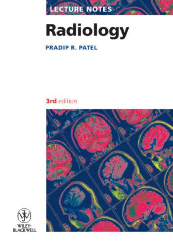 Lecture Notes: Radiology, 3rd Edition