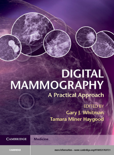 Digital Mammography : A Practical Approach