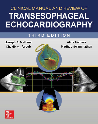 Clinical Manual and Review of Transesophageal Echocardiography