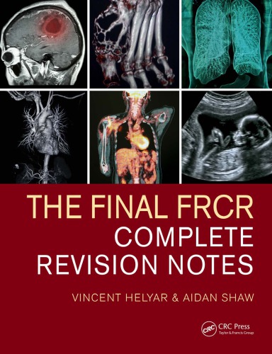 The final FRCR : complete revision notes