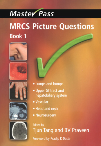 MRCS picture questions