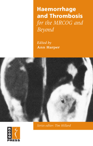 Haemorrhage and Thrombosis for the MRCOG and Beyond