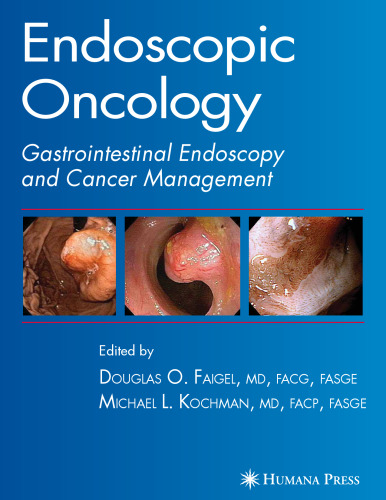 Endoscopic Oncology Gastrointestinal Endoscopy and Cancer Management
