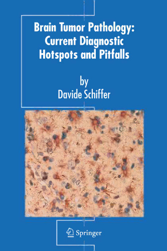 Brain Tumor Pathology: Current Diagnostic Hotspots and Pitfalls