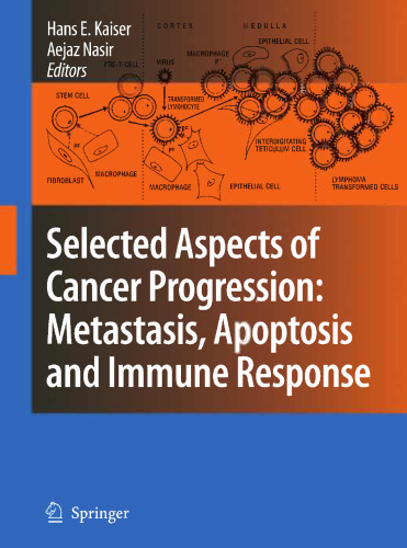 Selected Aspects of Cancer Progression: Metastasis, Apoptosis and Immune Response