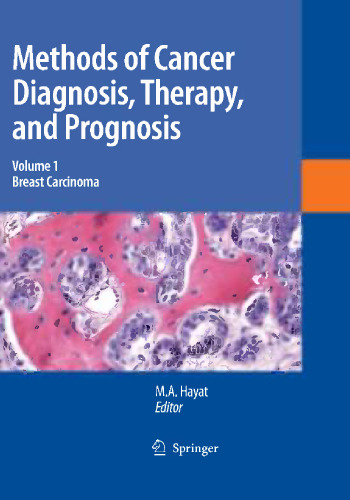 Methods of Cancer Diagnosis, Therapy and Prognosis: Breast Carcinoma