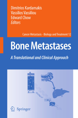 Bone Metastases: A translational and clinical approach