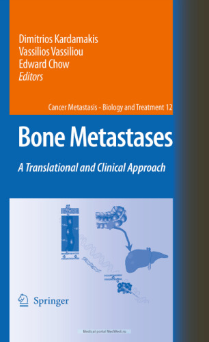 Bone Metastases: A translational and clinical approach