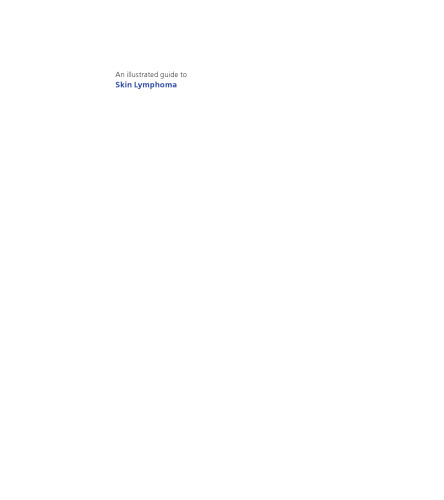 An Illustrated Guide to Skin Lymphoma, Second Edition