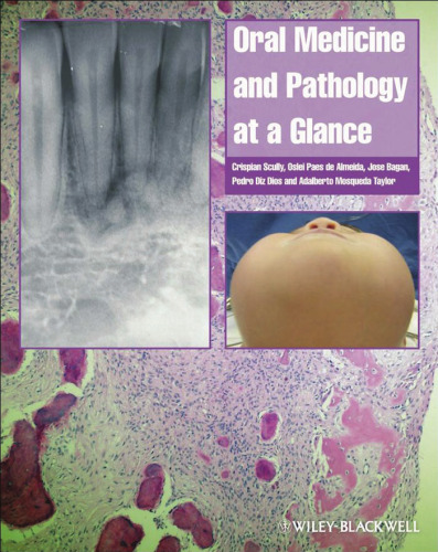 Oral medicine at a glance