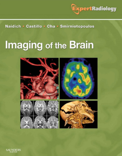 Imaging of the Brain: Expert Radiology Series