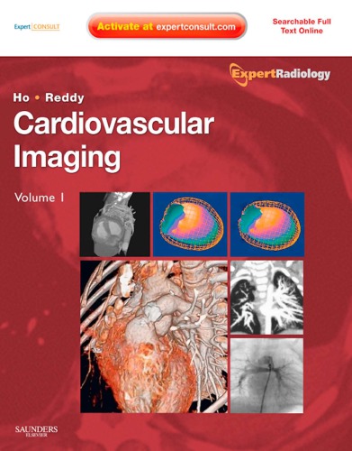 Cardiovascular imaging
