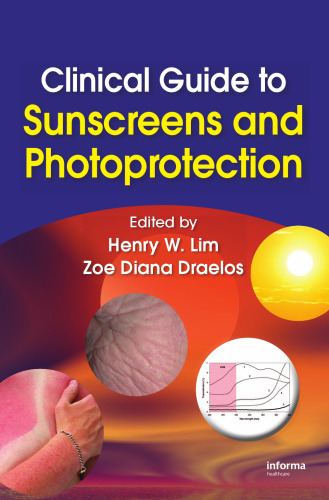 Clinical Guide to Sunscreens and Photoprotection (Basic and Clinical Dermatology)
