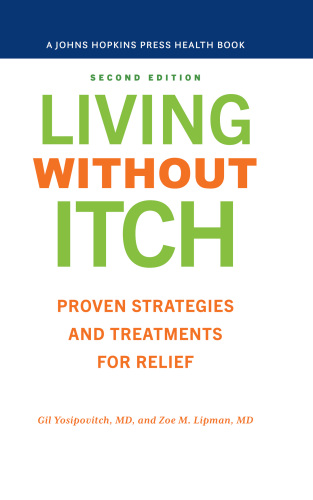 Living without Itch : Proven Strategies and Treatments for Relief