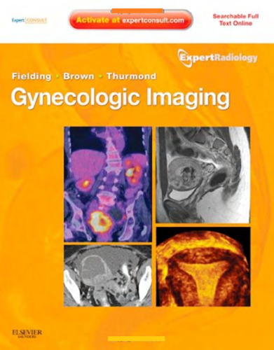 Gynecologic Imaging: Expert Radiology Series (Expert Consult Premium Edition - Enhanced Online Features and Print), 1e