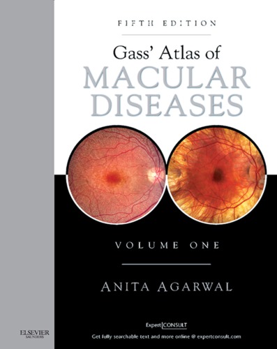 Gass' atlas of macular diseases. Vol. 1
