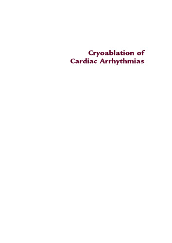 Cryoablation of Cardiac Arrhythmias