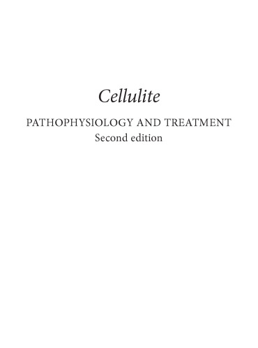 Cellulite : pathophysiology and treatment