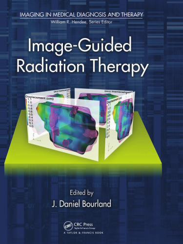 Image-Guided Radiation Therapy