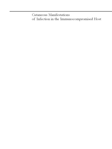 Cutaneous manifestations of infection in the immunocompromised host