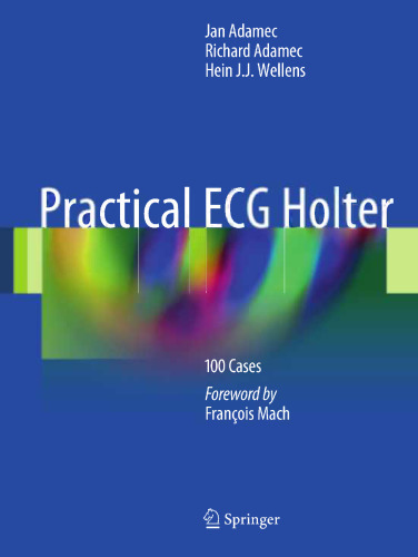 Practical ECG Holter: 100 Cases